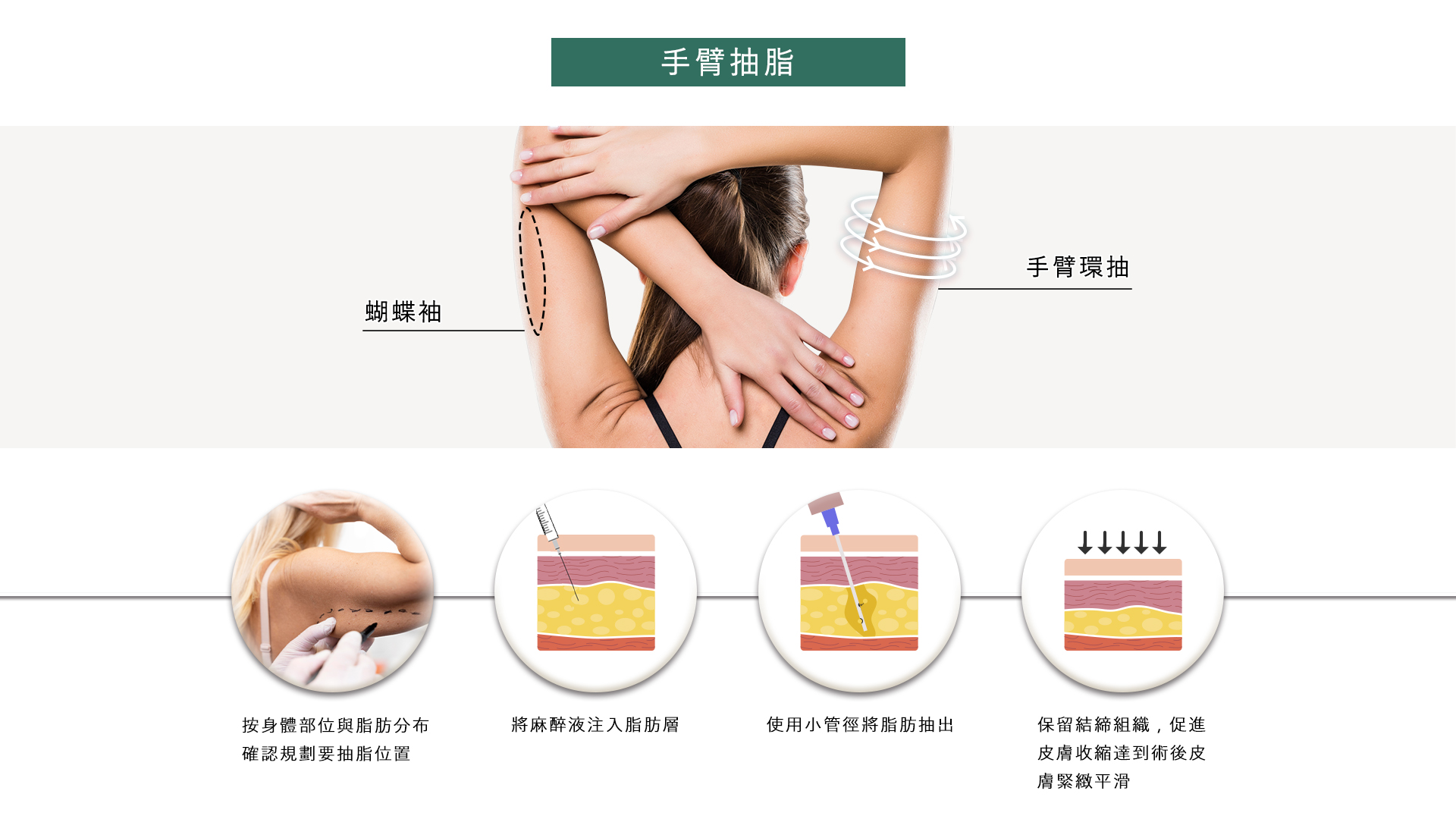 桃園抽脂手術_永恆醫美