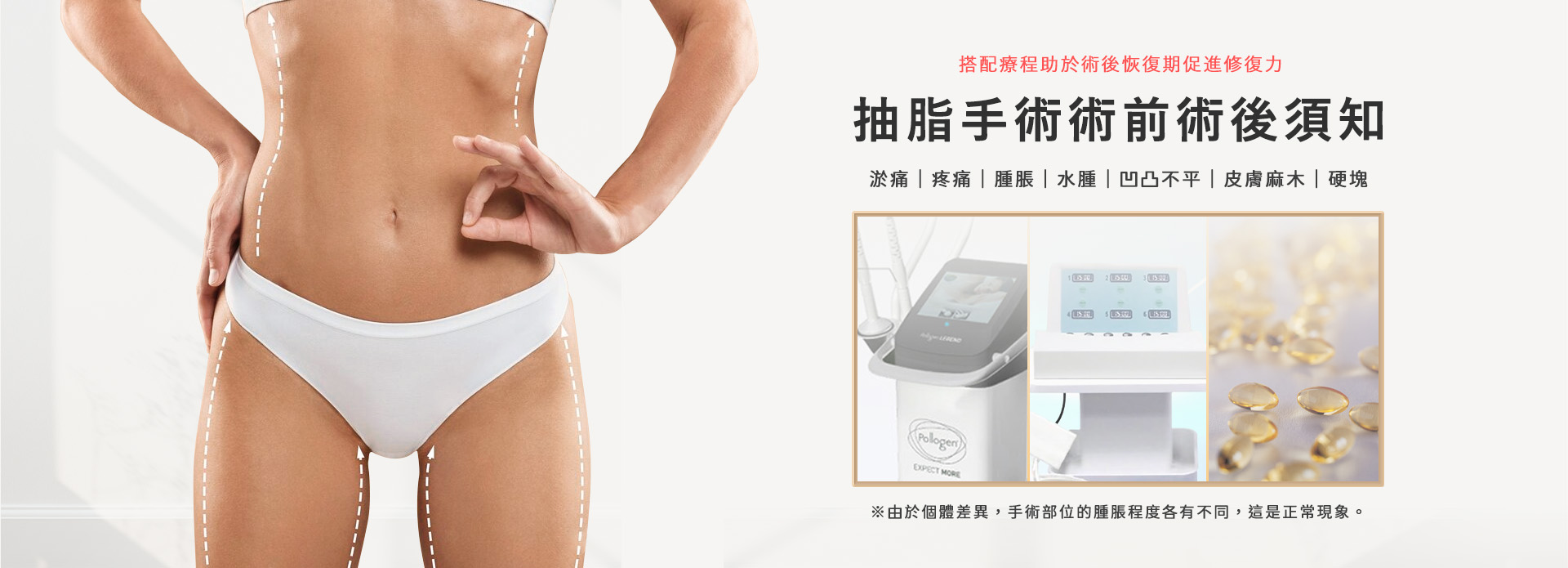 桃園抽脂手術_永恆醫美