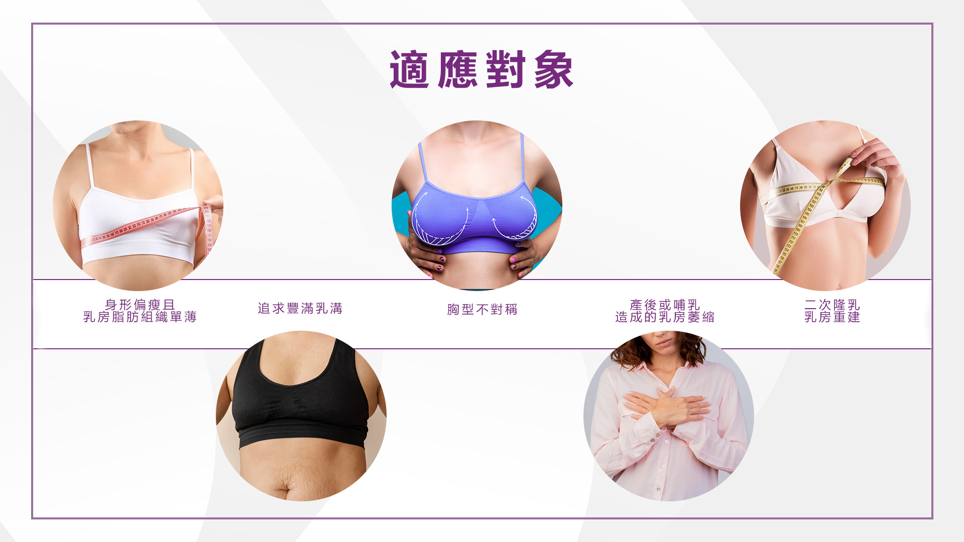 桃園Motiva魔滴2.0隆乳手術權威醫師推薦價格費用008