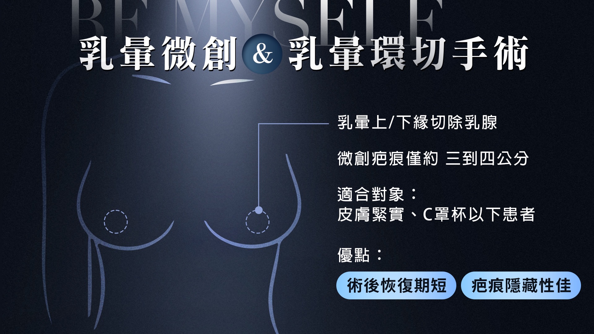 桃園平胸縮胸切乳手術權威醫師推薦004