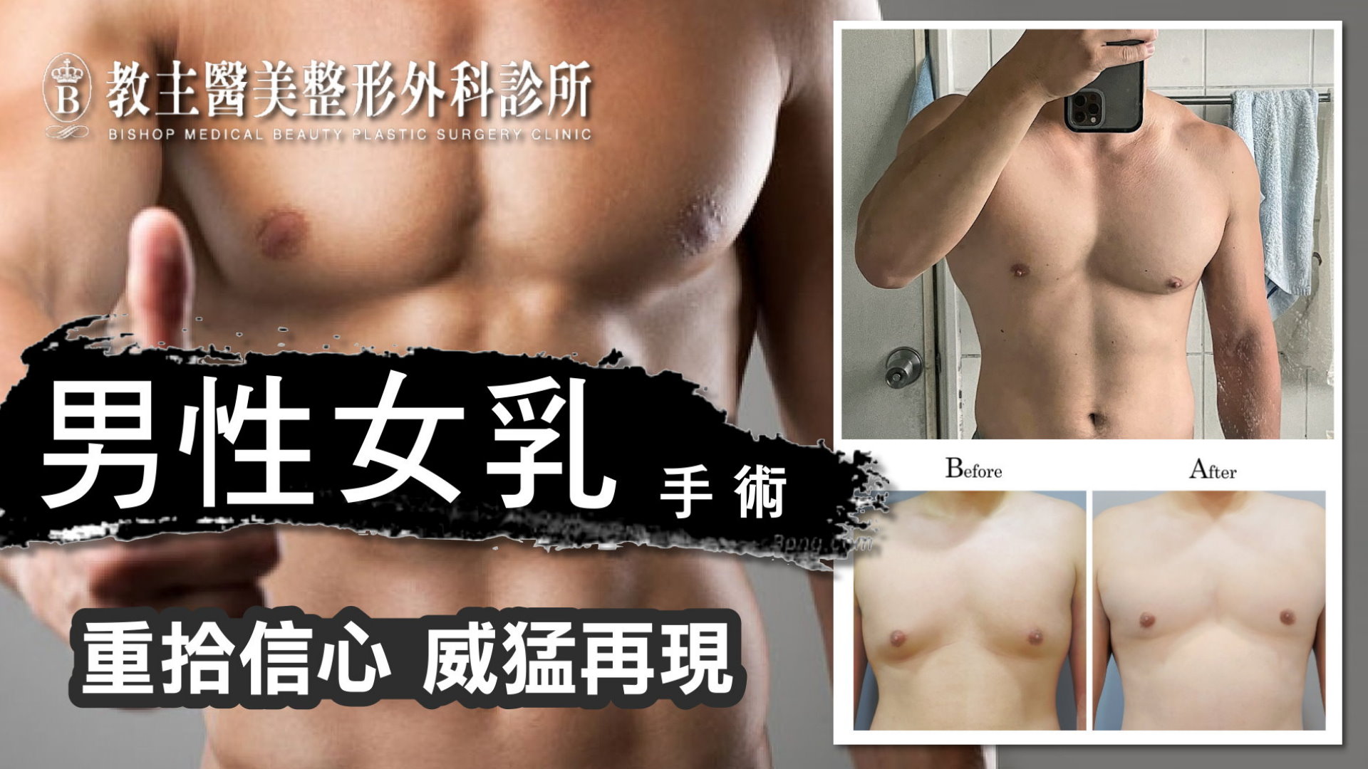 桃園男性女乳手術權威醫師推薦