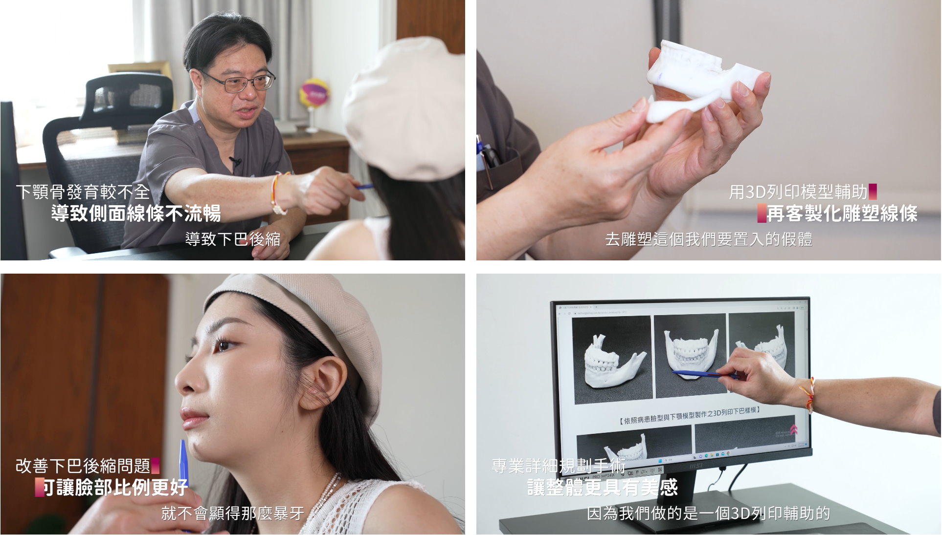 桃園3D列印墊下巴整形手術權威醫師推薦邱智弘醫師002