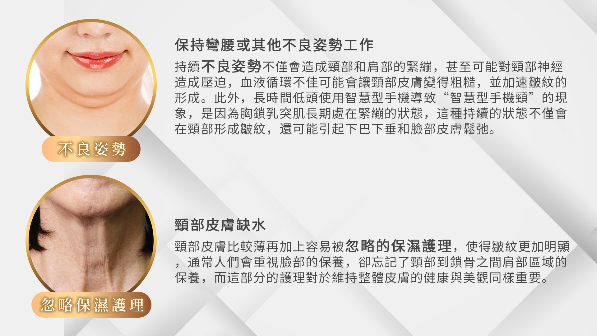 桃園天鵝頸手術權威醫師推薦002