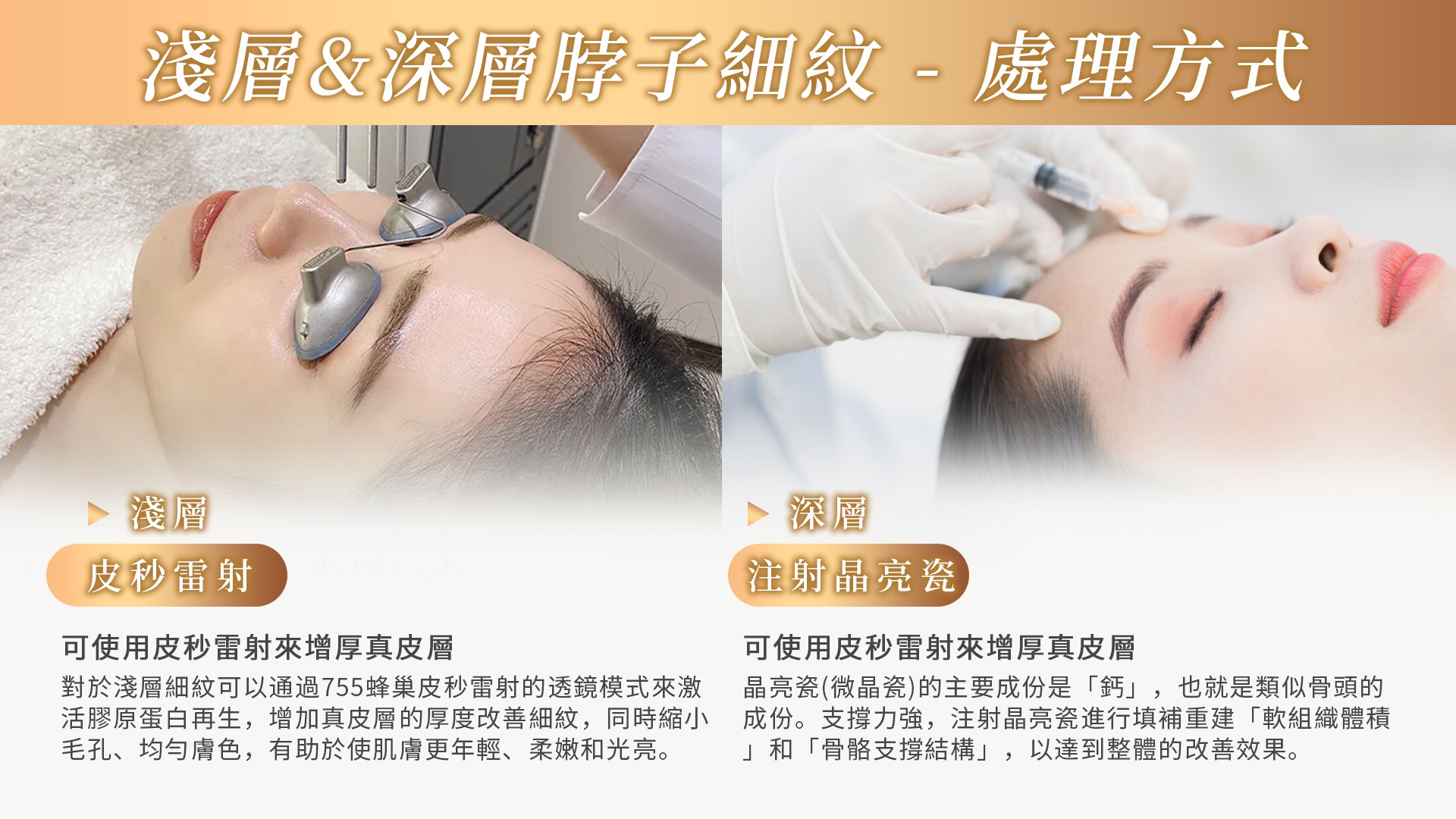 桃園天鵝頸手術權威醫師推薦008