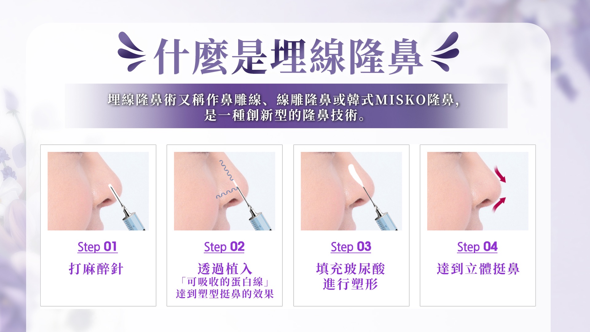 桃園埋線隆鼻權威醫師推薦價格費用002
