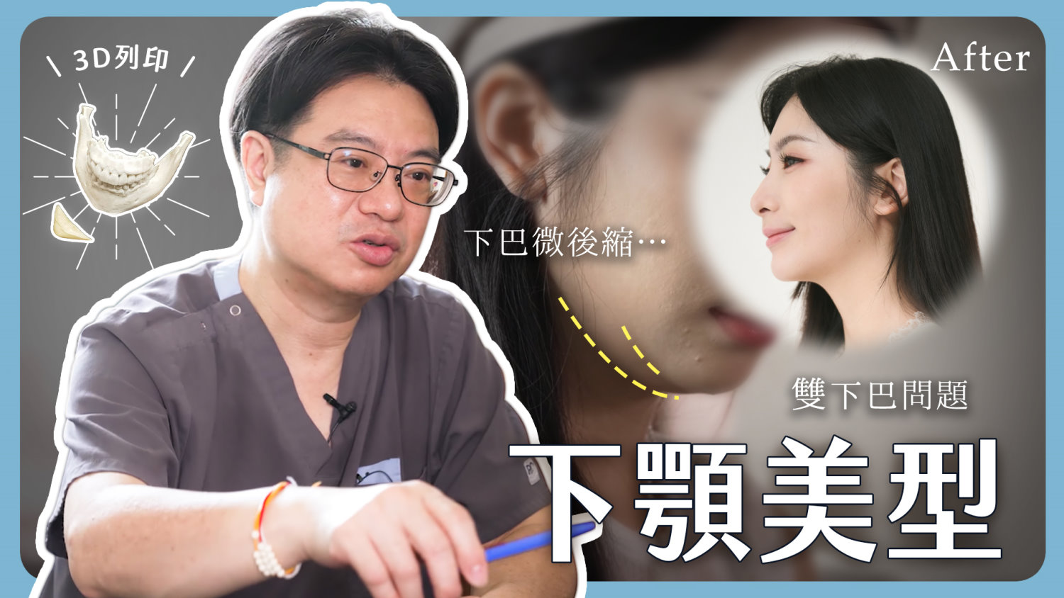 桃園墊下巴整形3D列印墊下巴權威邱智弘醫師推薦_韓系墊下巴