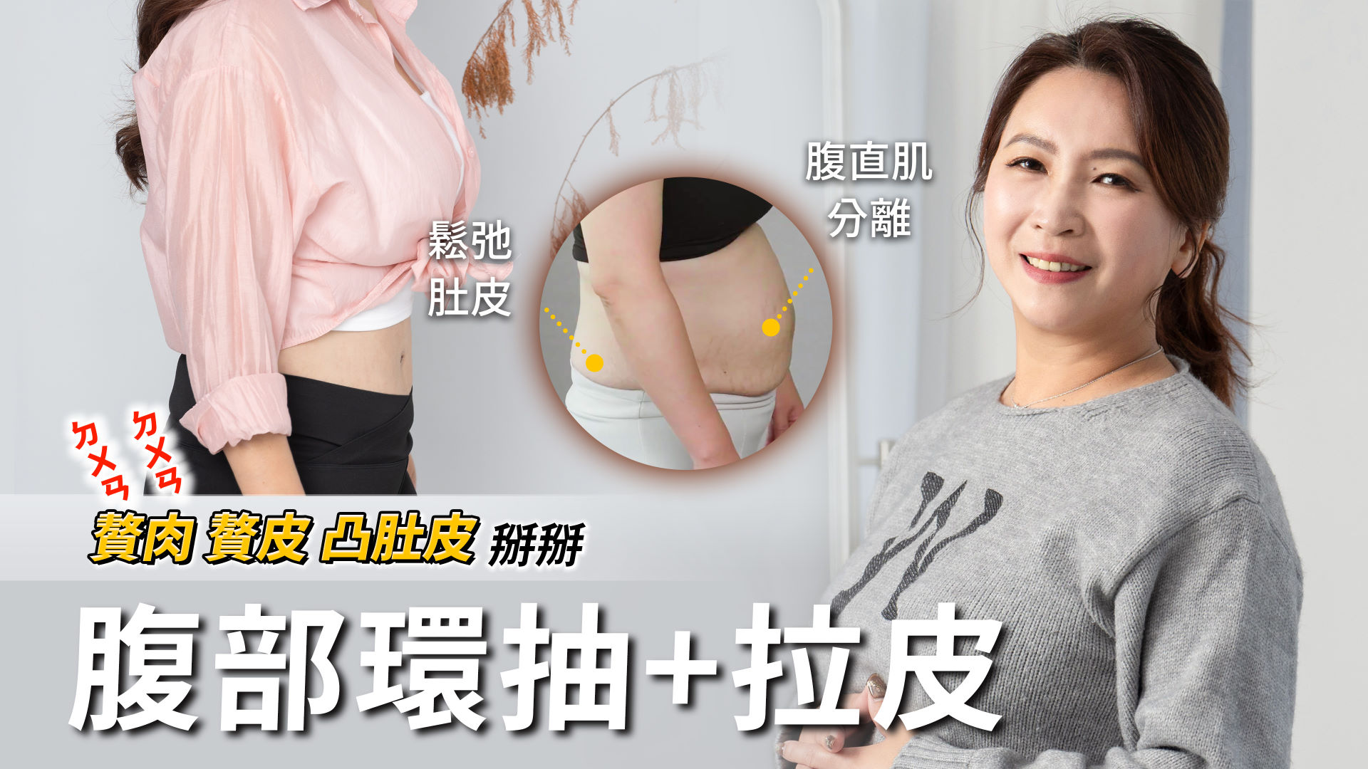 桃園腹部拉皮權威醫師推薦價格費用001