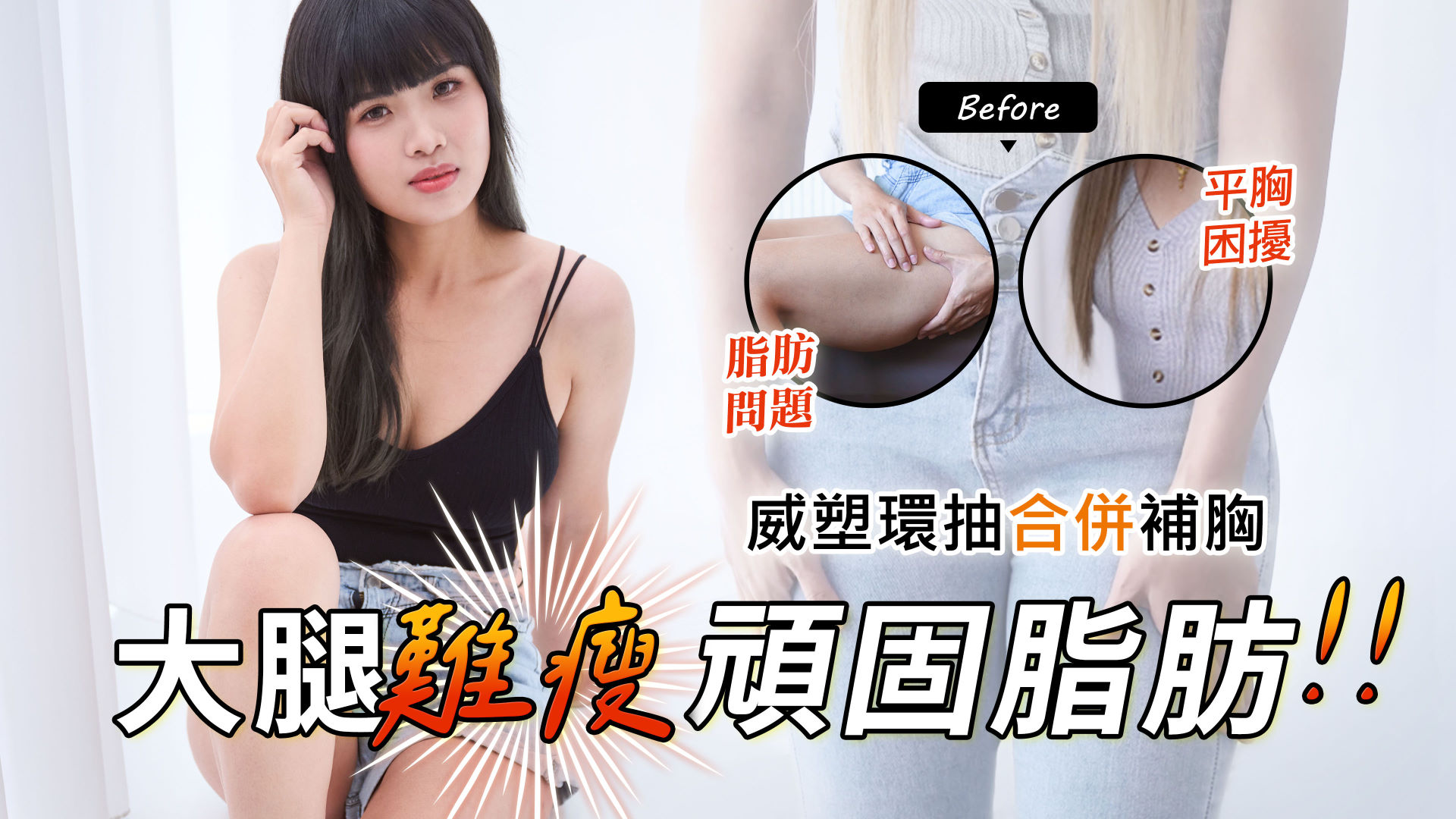 桃園抽脂推薦權威醫師永恆醫美整形01